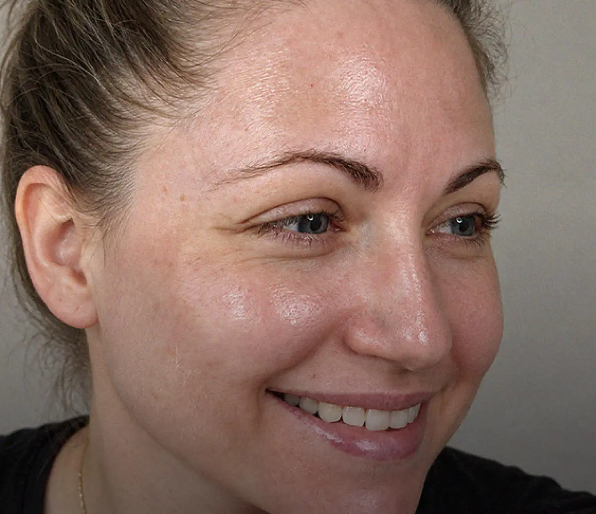 Antes · Serum Care Balance