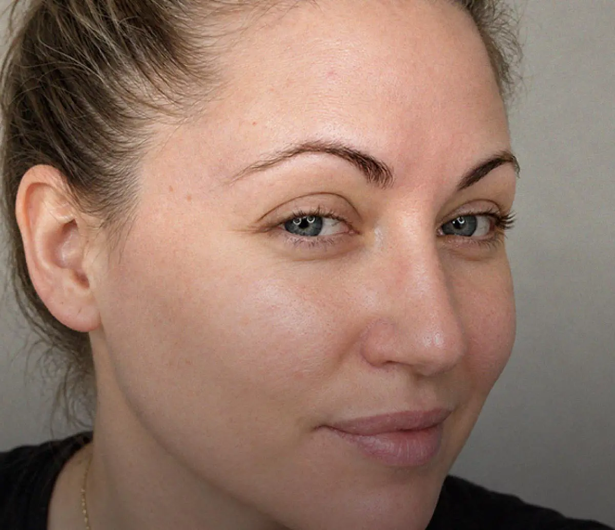 Después · Serum Care Balance